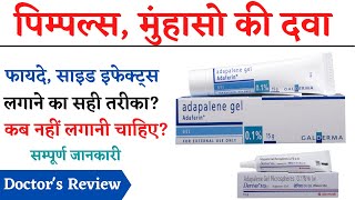 Adapalene Gel Uses Side Effects Review in Hindi  How to Apply Adapalene Gel  Pimples Ki Cream [upl. by Moritz]