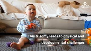 Down Syndrome Explained in a Minute  Child with Down Syndrome [upl. by Alyce76]