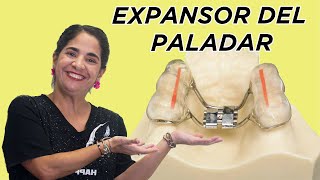 Expansor del paladar [upl. by Halilahk]