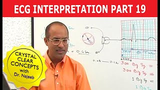 EKG or ECG Interpretation  Part 1920 [upl. by Nalyac279]