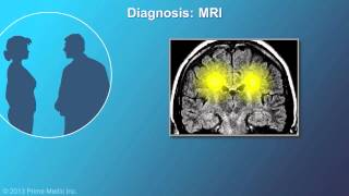 Diagnosis of Multiple Sclerosis [upl. by Ettennaj]