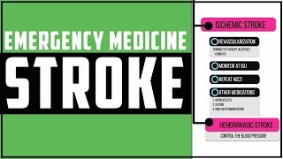 Acute management of Stroke Stroke Emergency management 2019 [upl. by Feliza]