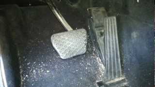 How to remove gas pedal off Bmw E46 330 325 E38 740 E39 M5 540i 530i 525i [upl. by Haisej]