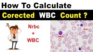 Corrected WBC Count  Clear Explain [upl. by Ilarrold]