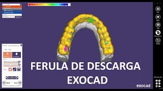 Ferula de descarga con exocad [upl. by Reames106]