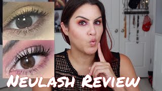 Neulash Review with Before and After [upl. by Shue]