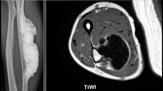 MSK Radiology Spotters radiopediafrcrctmrixraybonestipsamptricksmusculoskeletalexamscases [upl. by Thayer830]