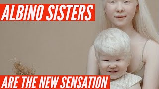 How Albino sisters became viral overnight [upl. by Ahsemik]