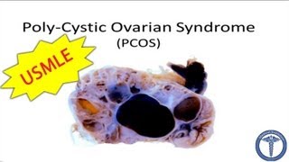 Polycystic Ovarian Syndrome PCOS  MADE EASY [upl. by Bobette]