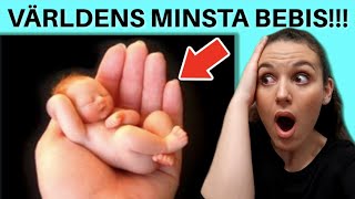 10 OFATTBARA BARN Världens minsta bebis [upl. by Kcireddor]