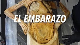 ¿Qué le hace el EMBARAZO a tu cuerpo [upl. by Zalea]