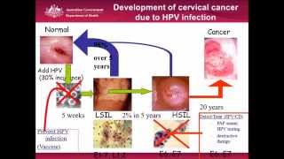 Cervical Cancer Screening Is this the end of the pap smear [upl. by Aicetel]