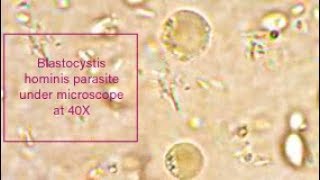 Blastocystis hominis parasite under microscope at 40X [upl. by Orose]