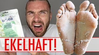 HORNHAUT ENTFERNEN mit HORNHAUTSOCKEN ● EKELHAFT aber GEIL [upl. by Eilsel761]