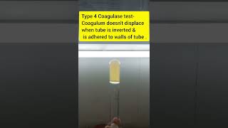 Grade 4 tube coagulase test staphylococcus coagulasetest [upl. by Ivzt]