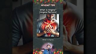 What is Angina Angina Pectoris [upl. by Garreth]