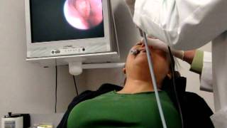 FinESS Sinus Treatment  Physician Instructional Video [upl. by Enyaz300]