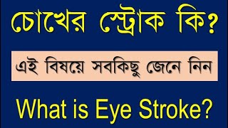 Eye Stroke bangla eyeStroke retinalIschemia retinalHemorrhages treatmentOfEyeStroke [upl. by Hasen387]