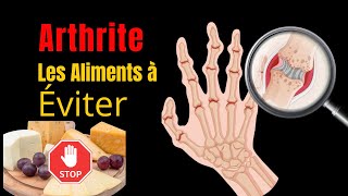 quotArthrite  Les 8 Aliments à Éviter Absolument Pour Protéger Vos Articulationsquot [upl. by Ahcropal]