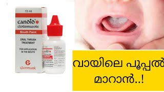 Clotrimazole mouth paint Malayalam review  candid mouth paint  വായിലെ പൂപ്പൽ മാറാൻ  antifungal [upl. by Krucik]