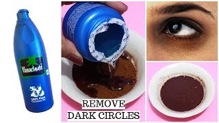 Remove Dark Circles Fast And Overnight  Dark circles under eyes home remedy [upl. by Lemraj]