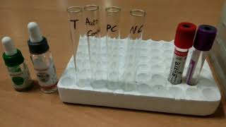 Coombs Test antiglobulin test [upl. by Jenkins881]