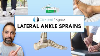 Lateral Ankle Sprains  Expert Explains Mechanism Of Injury and Rehab Plan [upl. by Eniamahs750]