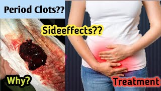 Clots In Period Blood  Period Clots Coming Out  Clots During Menstrual Period [upl. by Aliahs]