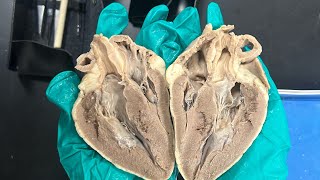 STEM SOS 2024205 Heart Model and dissection [upl. by Anselmi977]