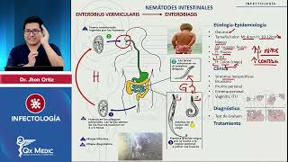 Parásitos Nematodos Intestinales Trichuris Enterobius Ascaris Strongyloides Uncinarias mp4 [upl. by Legge]