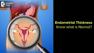 Endometrial Thickness Know what is Normal   Dr H S Chandrika  Doctors Circle [upl. by Quarta]