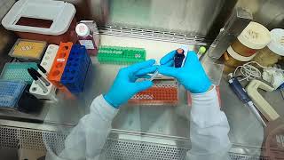 POV How To Do a Transfection [upl. by Lorou]