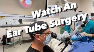 Ear Tube Surgery actual video  myringotomy tympanostomy ventilation tube placement [upl. by Lambart619]