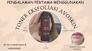 REVIEW TONER EKSFOLIASI AVOSKIN  MIRACULOUS REFINING TONER  femirambu [upl. by Braunstein]