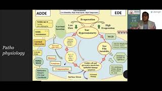 Lecture Dry Eye Evolving Diagnostics and Care [upl. by Reinwald168]