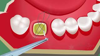 Sutures and Suturing TechniquesOral Surgery [upl. by Eldridge]