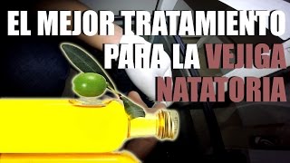 TRATAMIENTO PARA VEJIGA NATATORIA 100 RECOMENDABLE [upl. by Alphonsa]