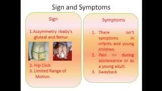 PPT English Congenital Hip Dysplasia [upl. by Zorah]