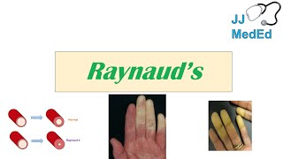 Introduction to Raynaud’s Phenomenon Syndrome  Pathophysiology Triggers Symptoms Treatment [upl. by Budworth]