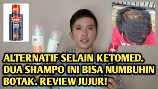 ALTERNATIF SHAMPO SELAIN KETOMED UNTUK MENUMBUHKAN RAMBUT BOTAK TENGAH REVIEW REVITA DAN ALPECIN [upl. by Urson]