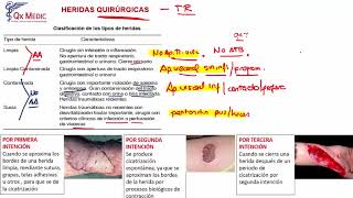 Cirugía plástica  1 RM19 2V DIA 2 CIRUGÍA PLASTICA HERIDAS Y SUTURAS de Qx Medic on Vimeo [upl. by Virgel]