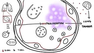 Pneumocystis jirovecii  Pneumocystis pneumonia [upl. by Ayotaj]