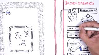 Hyponatraemia Hyponatremia  classification causes pathophysiology treatment [upl. by Anoek]