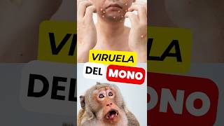 📛Descubre los Síntomas de la VIRUELA del MONO virueladelmono mpox [upl. by Kissiah]