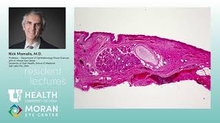 Pathology Lecture Conjunctiva [upl. by Sanferd766]