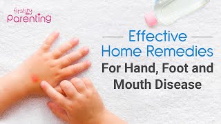 8 Effective Home Remedies for Hand Foot and Mouth Disease in Children [upl. by Wolbrom387]