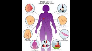 chronic mastitis specific and non specific [upl. by Elpmet85]