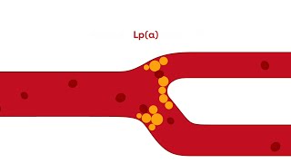 What is Lipoprotein a [upl. by Atteyek]