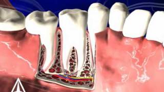 Tooth Anatomy  3D Medical Animation [upl. by Llehsram89]