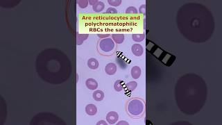 Is reticulocyte the same as polychromatophilic RBC shorts medtech medtechstudent foryou fyp [upl. by Assili]